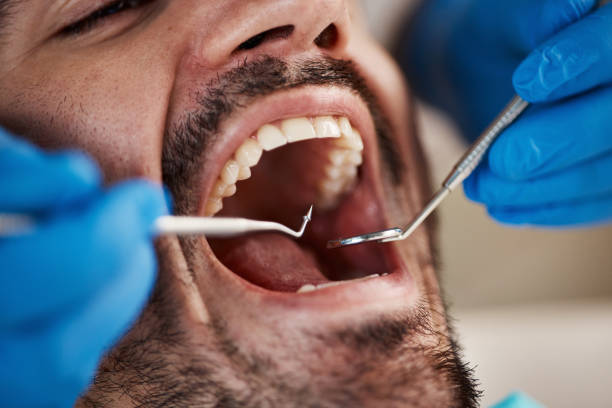 Best Teeth Whitening  in Rantoul, IL